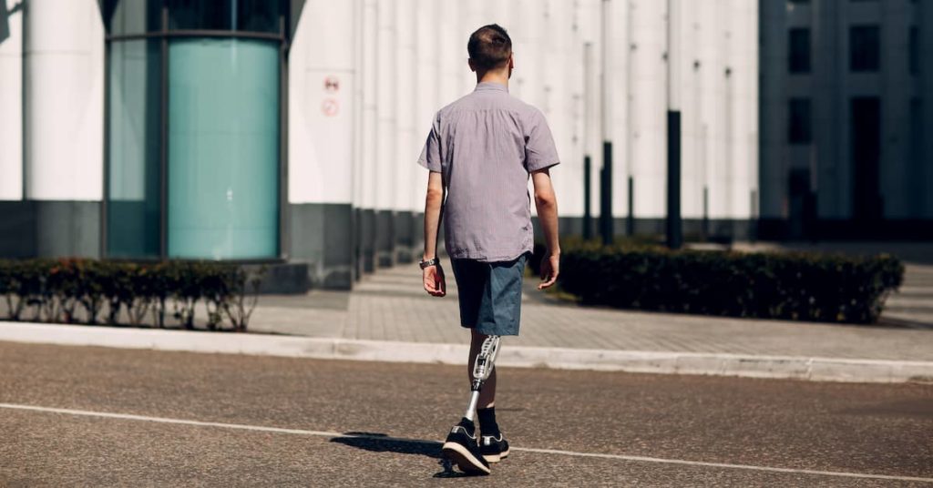 young man with prosthetic leg walking along the street