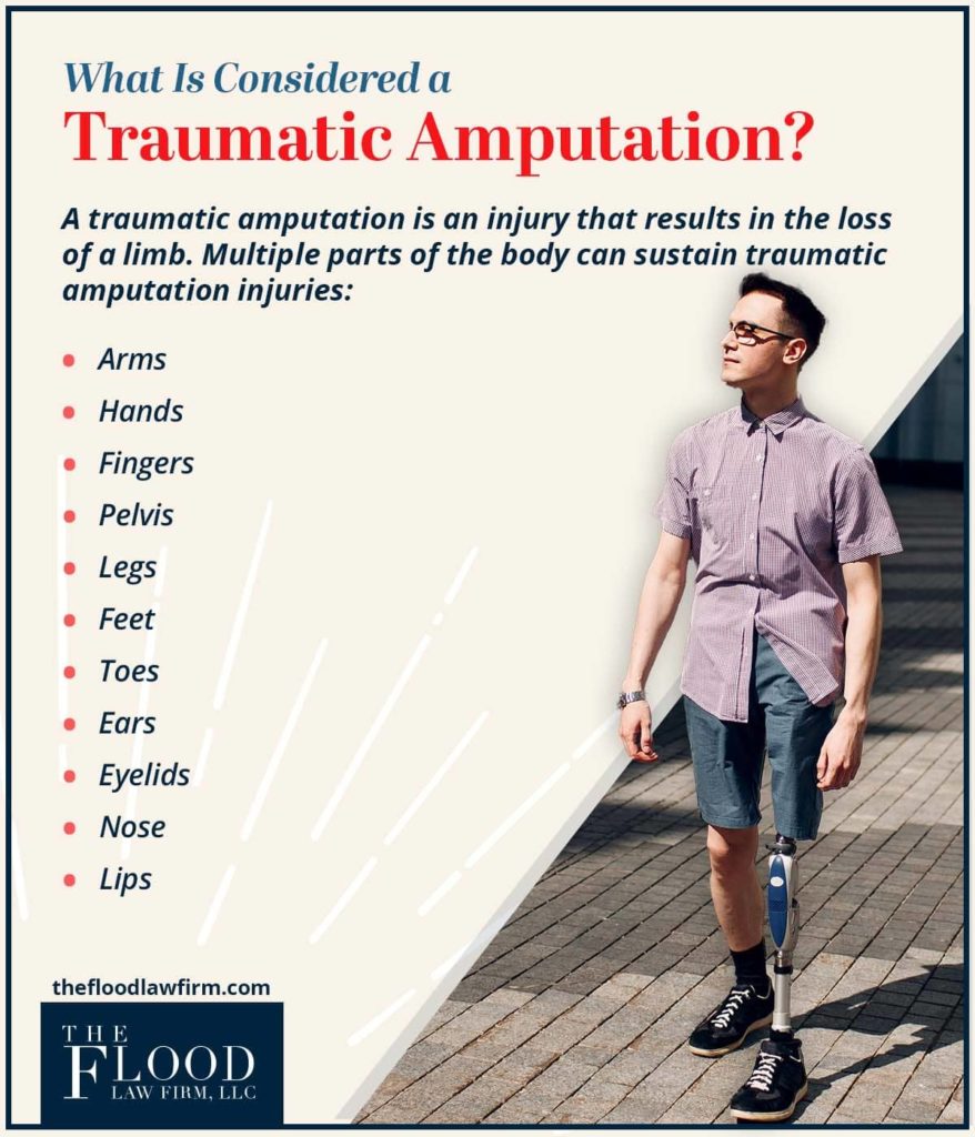 what is considered a traumatic amputation?