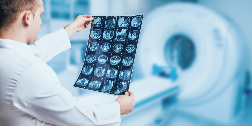 Doctor examining an MRI scan using advanced medical equipment.