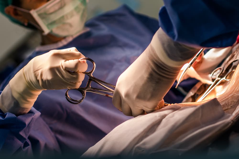 Traditional cesarean section in the operating theater or labor room, illustrating a common surgical childbirth procedure.